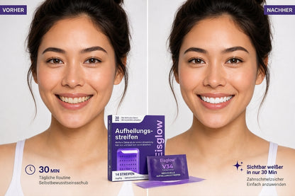 Pure Smile Bleaching-Strips